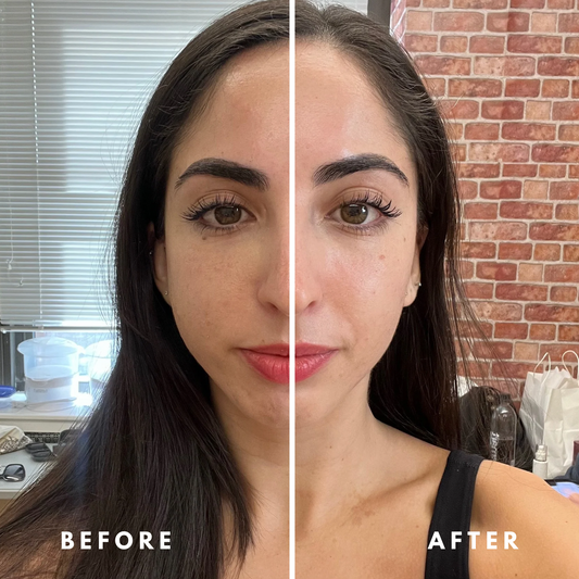 GLYDE™ Facial Brush